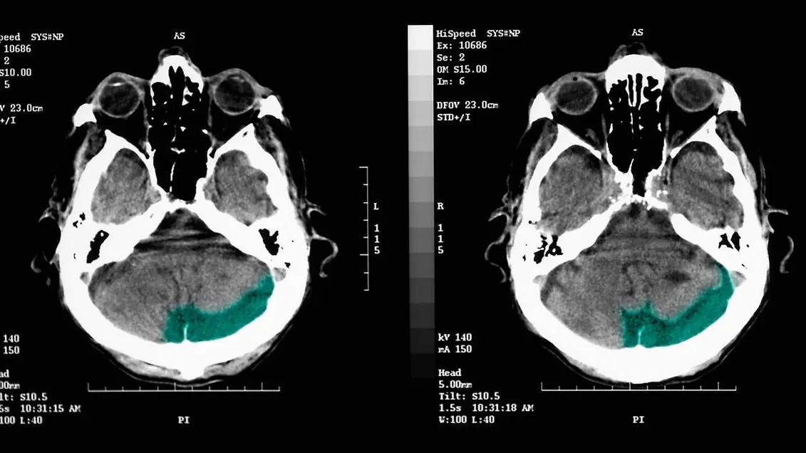 Can AI Read MRI and CT Scans Accurately?